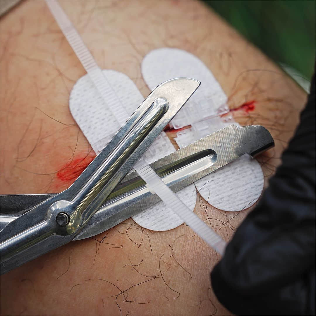 Kit per la chiusura delle ferite (10 pezzi)