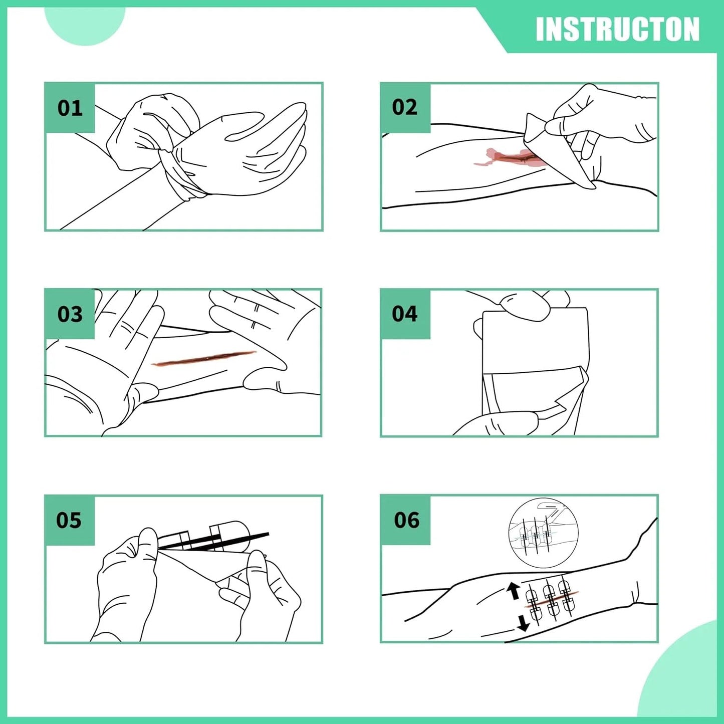Kit per la chiusura delle ferite (10 pezzi)