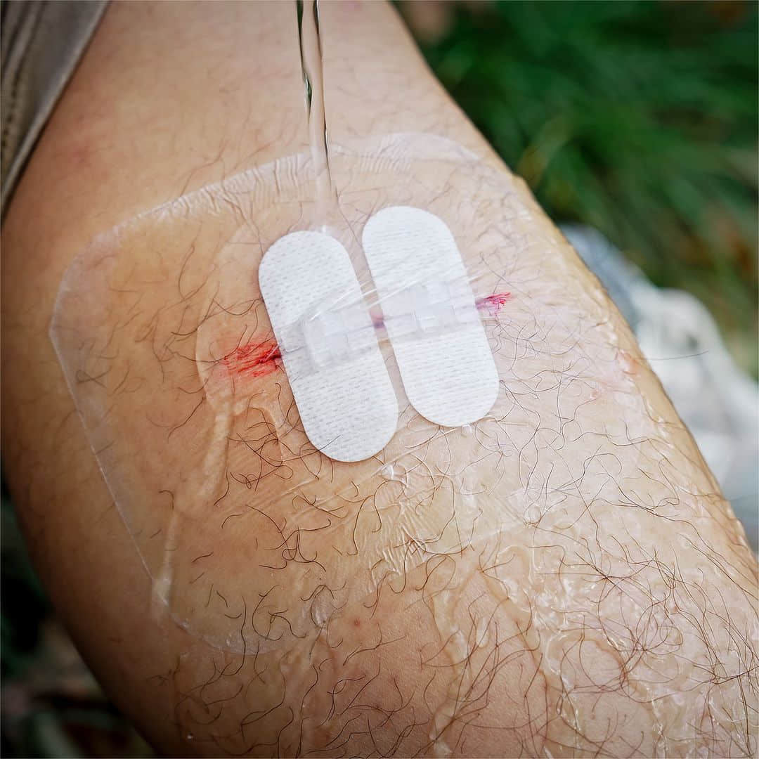 Zip Stitch (6 pezzi) ➤ Trattare i tagli